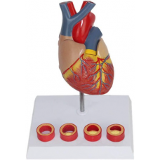 Human Heart and Thrombosis Model, 2 Parts